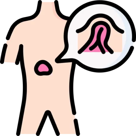 procedimiento cirugía de hernia abdominal del doctor alberto garcia
